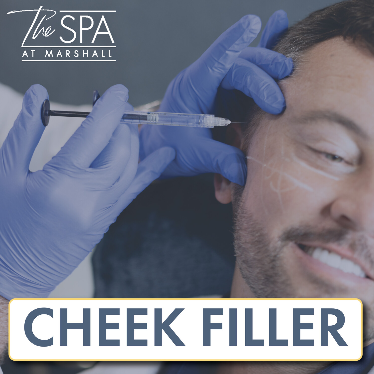Cheek Filler