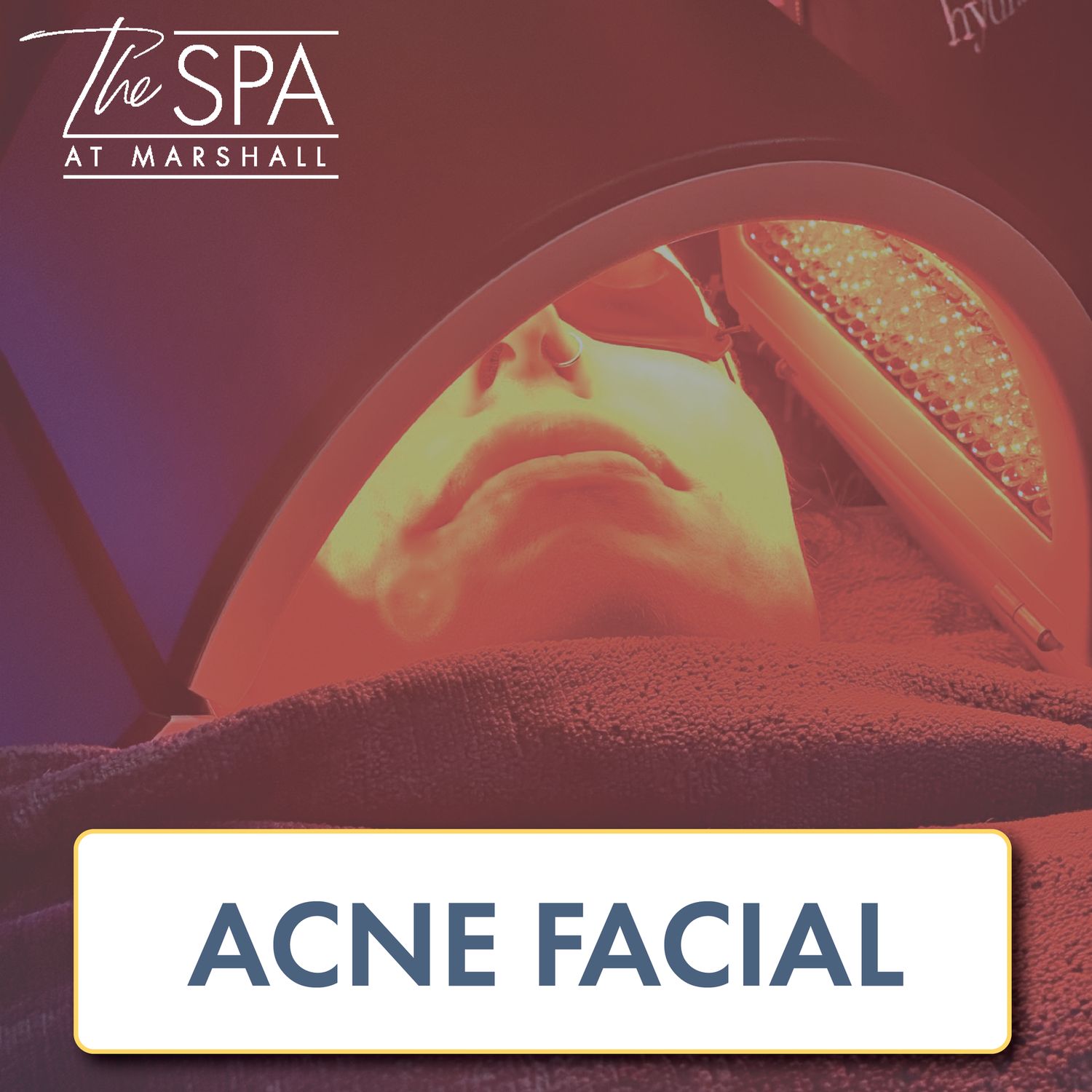 Acne Facial