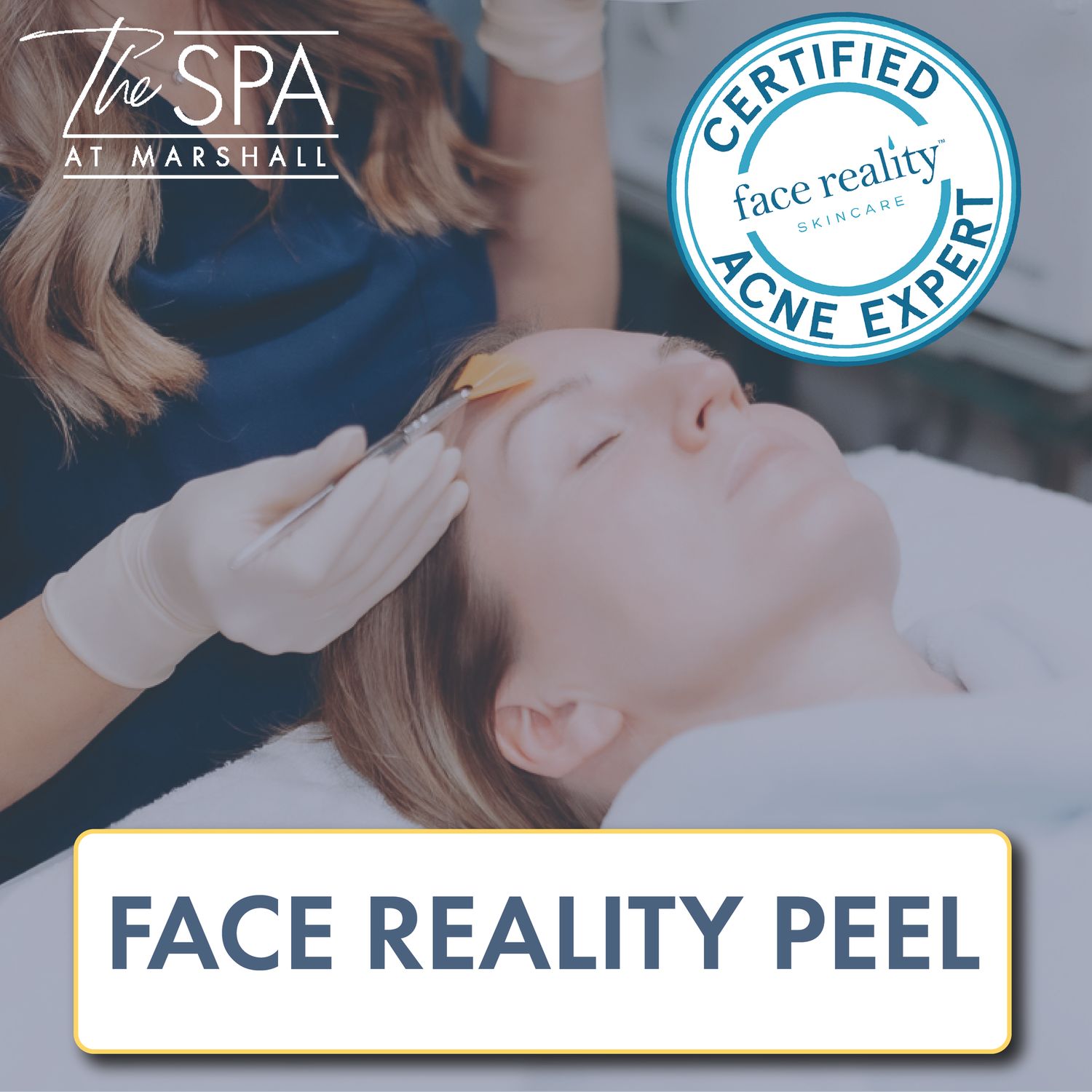 Face Reality Peel