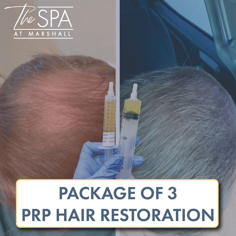 PRP Hair Restoration - Package of 3