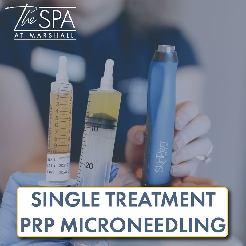 PRP Microneedling Single Treatment