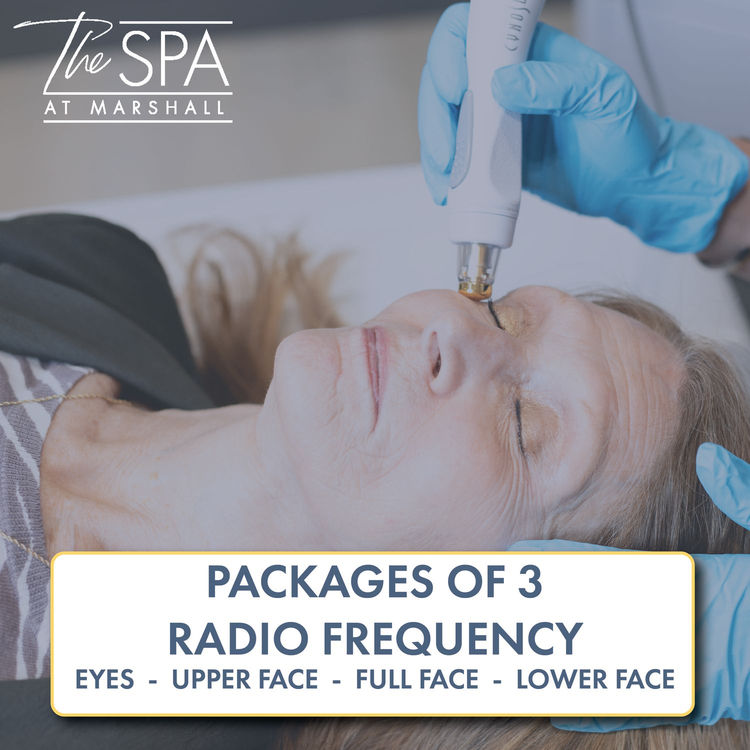 Radio Frequency: Packages of 3
