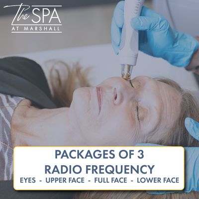 Radio Frequency: Packages of 3