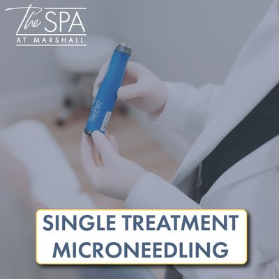 Microneedling Single Treatment