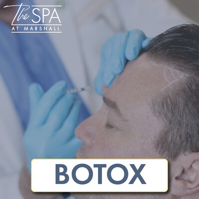 Botox Botox