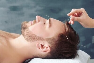 Basic Scalp Acupuncture Workshop