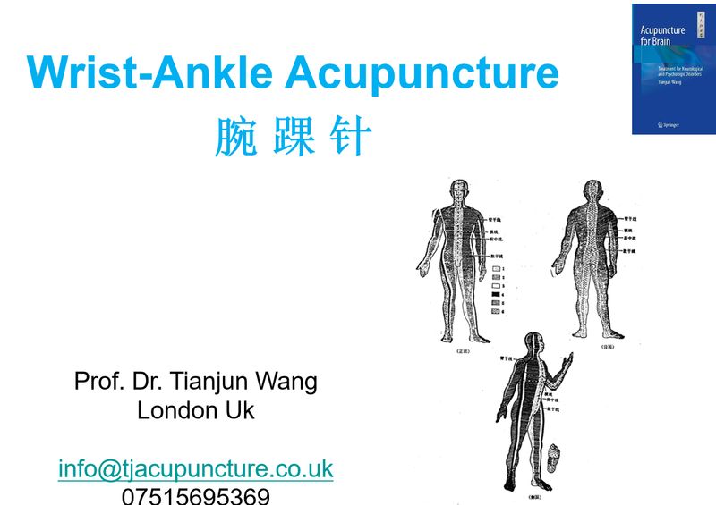 Wrist-Ankle Acupuncture workshop Wrist-Ankle Acupuncture workshop