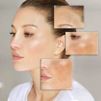 Skin Brightening