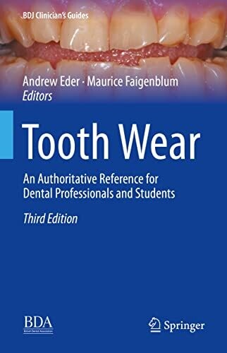 Tooth Wear: An Authoritative Reference For Dental Professionals And Students (Bdj Clinician�S Guides)