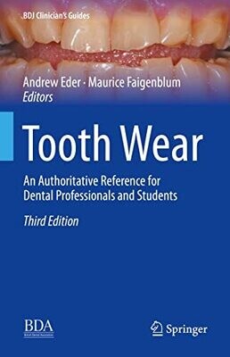 Tooth Wear: An Authoritative Reference For Dental Professionals And Students (Bdj Clinician�S Guides)
