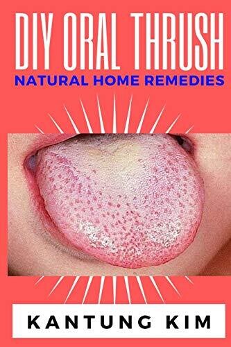 DIY Oral Thrush Natural Home Remedies: The Effective Step By Step Guide To Permanently End Oral Thrush