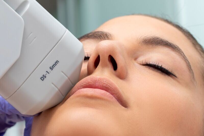 Hifu Face Lift Ultrasound Full Face Per Session