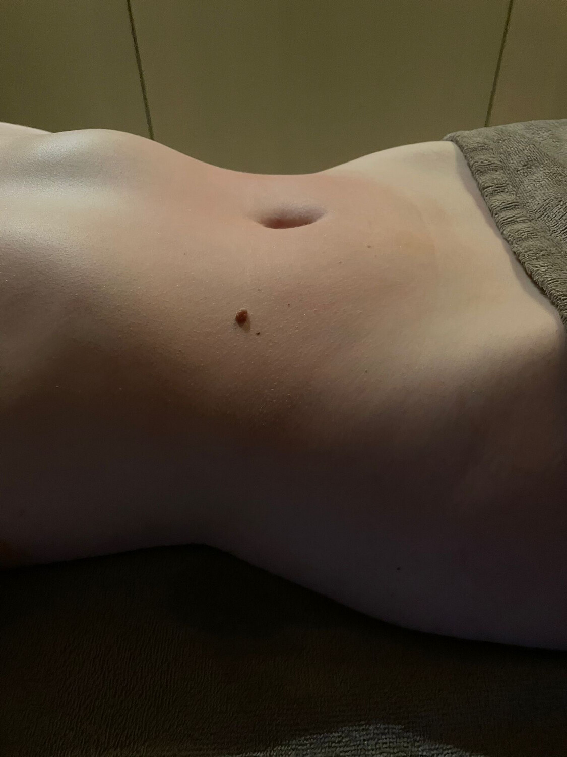 Reduce and Shape Treatment