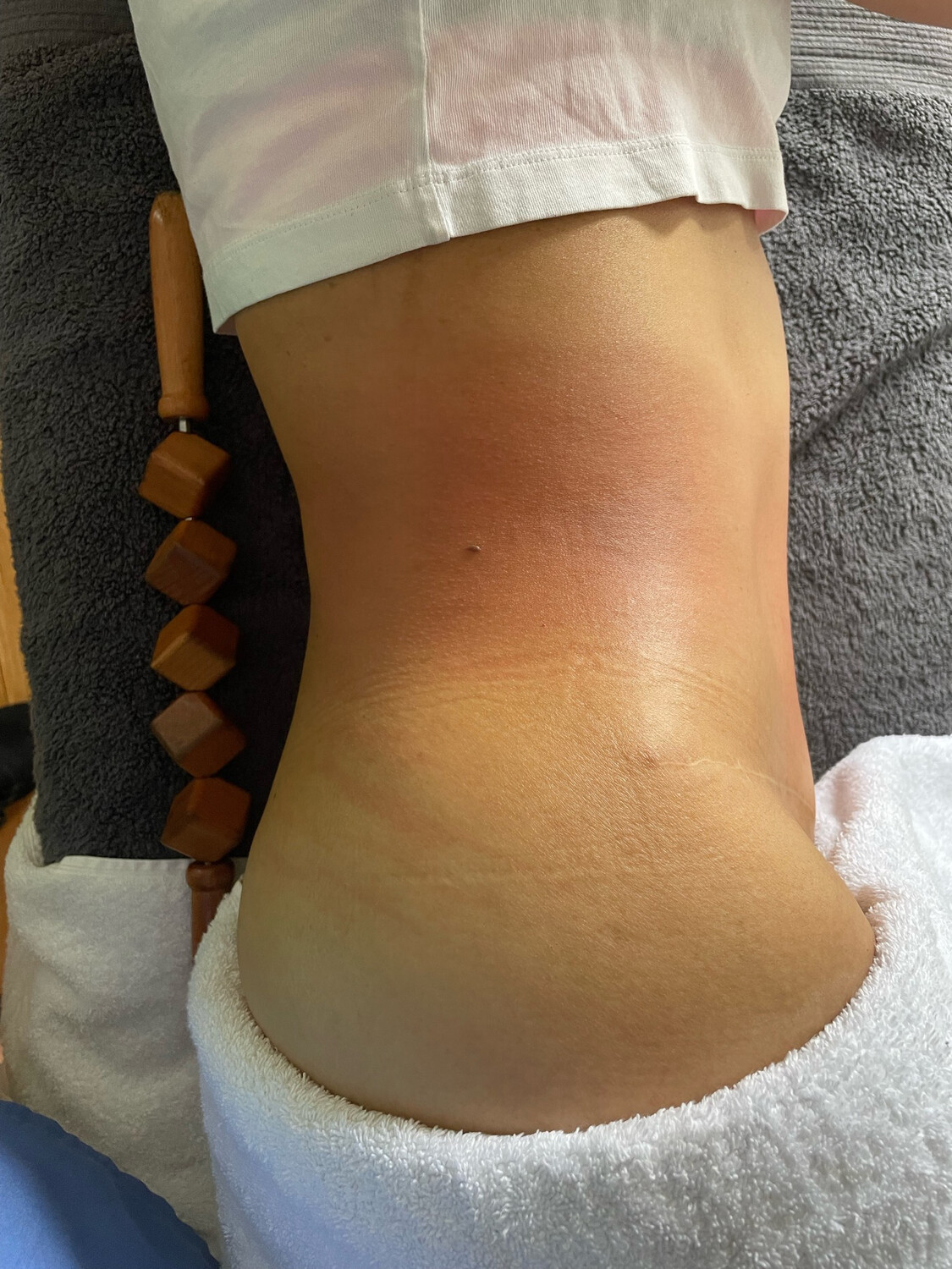 Reduce and Shape Treatment