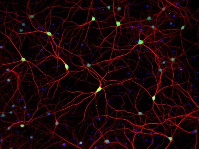 A21207 Invitrogen Donkey anti-Rabbit IgG (H+L) Highly Cross-Adsorbed Secondary Antibody, Alexa Fluor™ 594 1MG