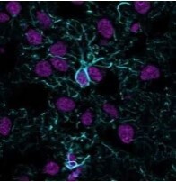 GFAP Antibody (ASTRO/1974R) [Alexa Fluor® 647] - 100uL - NBP3-08431AF647