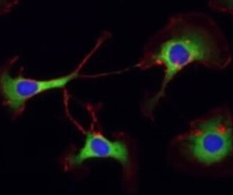 Anti-PABP antibody, 100ug -  ab21060