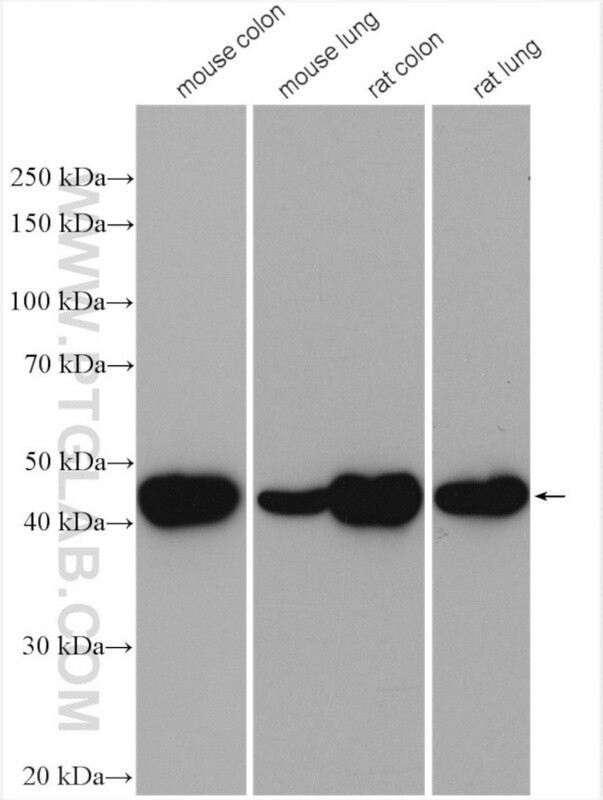 Alpha SMA Polyclonal Antibody