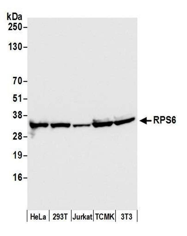 RPS6 Polyclonal Antibody - 100uL - A300-557A