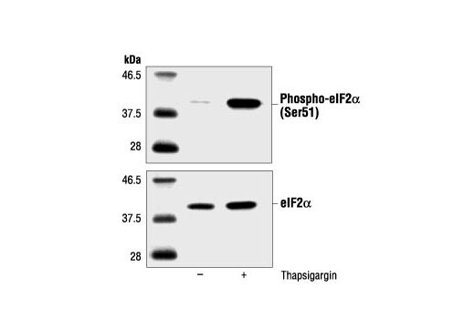 Phospho-eIF2α (Ser51) Antibody - 100ul - 9721S