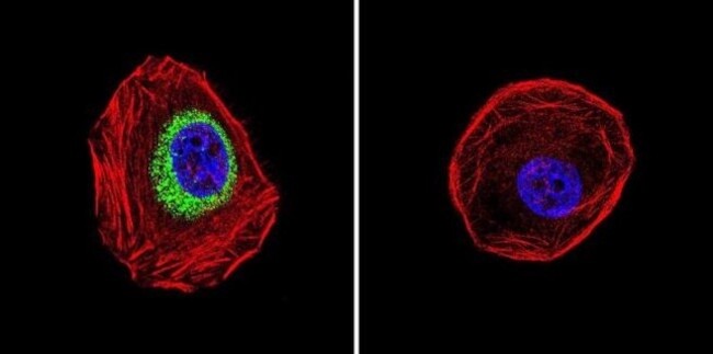 iNOS Polyclonal Antibody