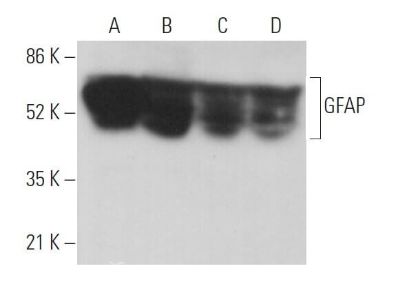 GFAP Antibody (2E1) Alexa Fluor® 647 -  sc-33673 AF647 - 200 µg/ml