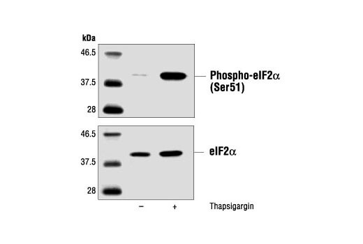 eIF2α Antibody  - 100ul - 9722S