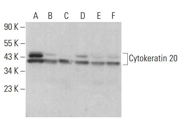 Cytokeratin 20 Antibody (E-9) Alexa Fluor® 488 -  sc-271183 AF488 - 200 µg/ml