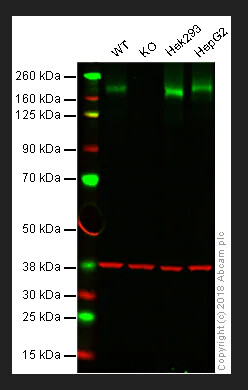 Recombinant Anti-Niemann Pick C1 antibody [EPR5209] - BSA and Azide free, 100ug - ab224268