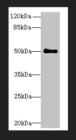 Anti-IFI44 antibody, 100ug -  ab236657