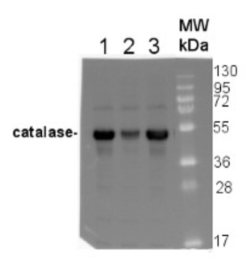 Cat | Catalase (peroxisomal marker) - 50ul - AS09501