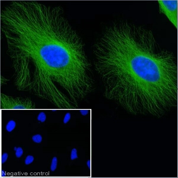 Goat Anti-Rat IgG H&amp;L (Alexa Fluor® 488) - 500ug -  ab150157