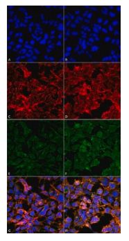 Monoclonal Anti-Malondialdehyde antibody produced in mouse - 100uG - SAB5202544