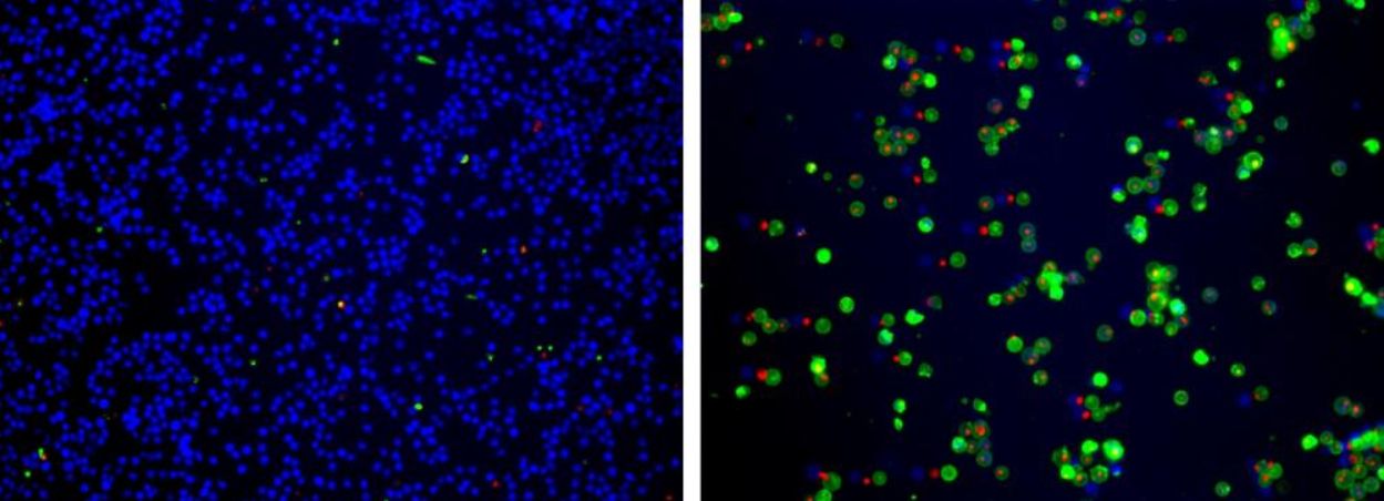 Aat Bioquest Cell Meter Apoptotic and Necrotic Multiplexing Detection Kit I Triple Fluorescence Colors (100 Tests)