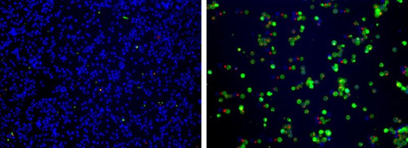 Aat Bioquest Cell Meter Apoptotic and Necrotic Multiplexing Detection Kit I Triple Fluorescence Colors (100 Tests)
