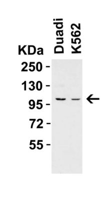 ProSci 7793_S PPARGC1A Antibody, ProSci, 0.02 mg/Unit - GS1-6162