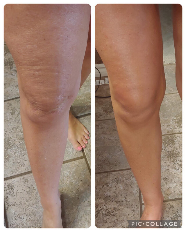 Dermatic Effects Contouring Lotion