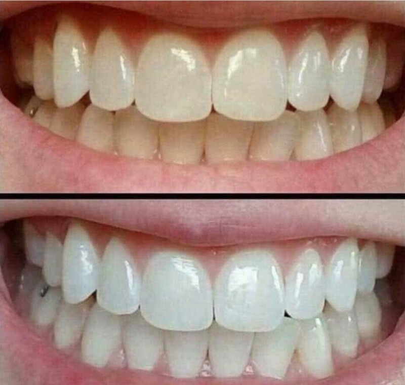 Teeth &amp; Tan Bundle