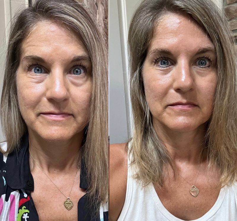 Retinol Peptide Serum