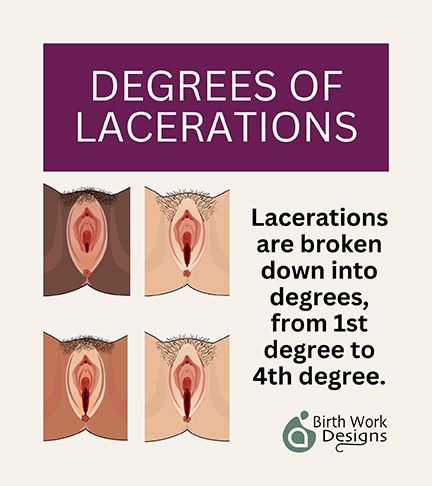 LACERATIONS