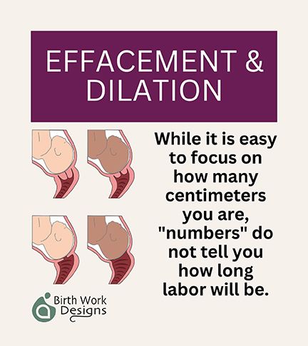 EFFACEMENT AND DILATION