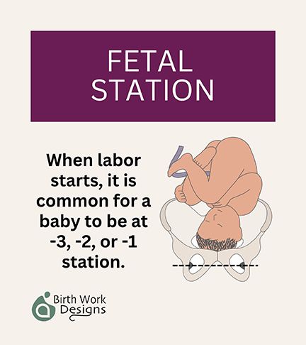 FETAL STATION