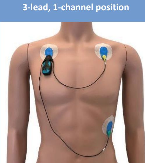 Bittium Faros waterproof ECG cable 3 electrodes (9404266) Bittium Faros waterproof ECG cable 3 electrodes (9404266)