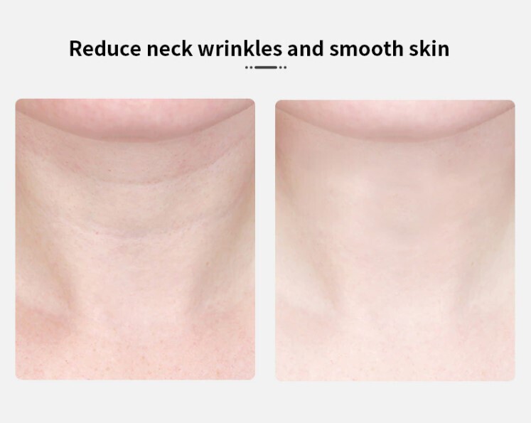 Facial rejuvenation/anti-ageing device