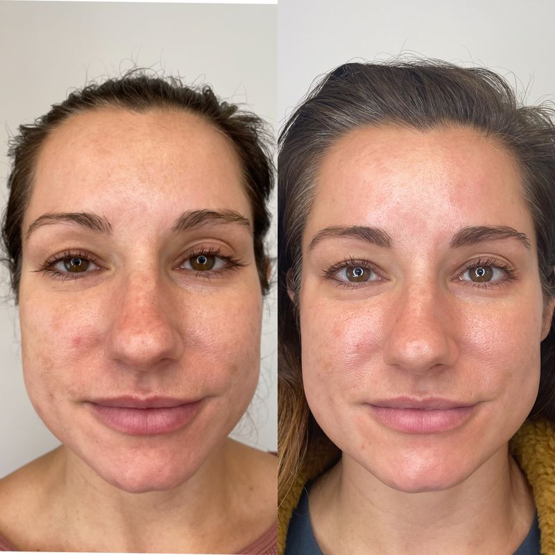 Anti-Inflammatory Package (6 treatments) Anti-Inflammatory Package (6 treatments)