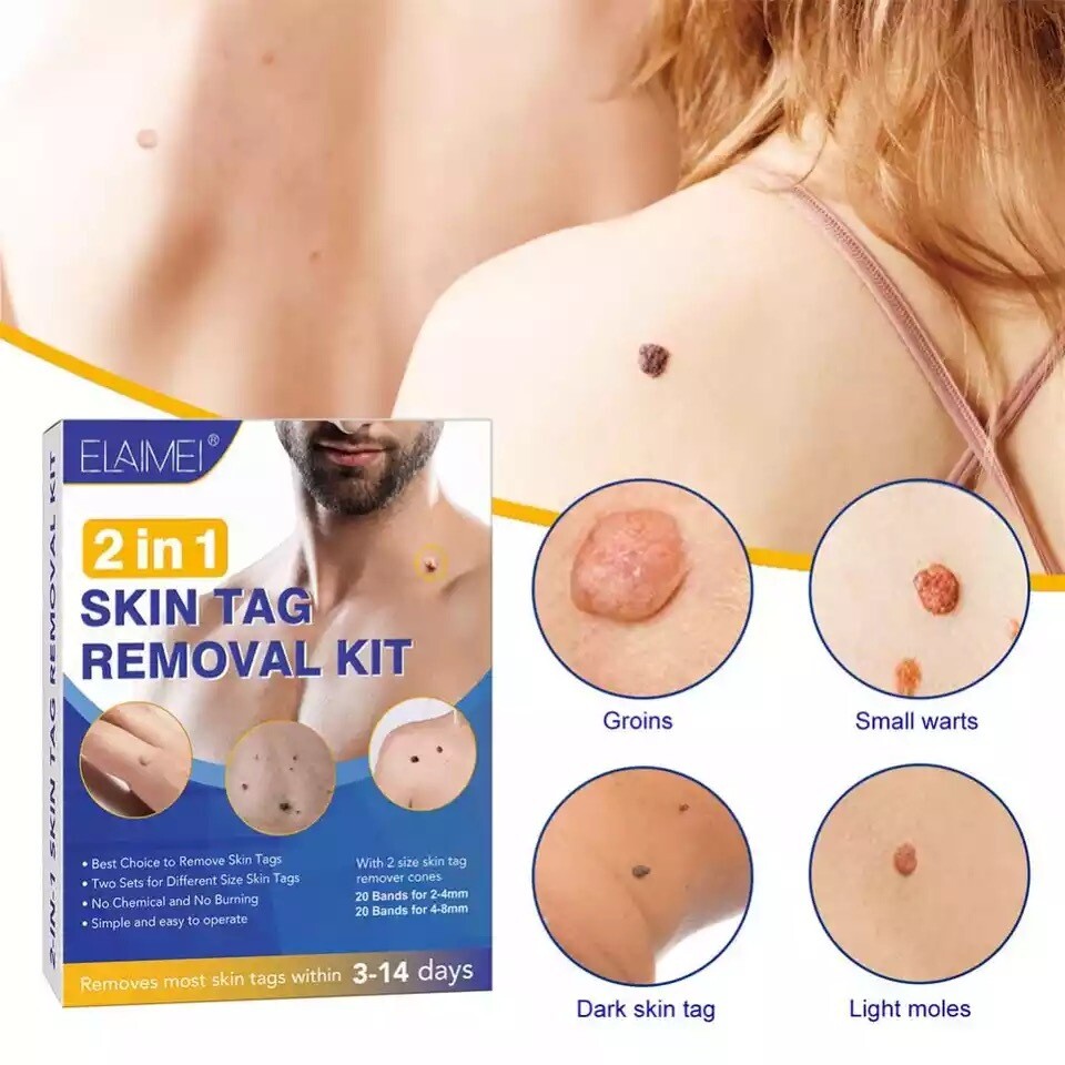 58PCS Auto Skin Tag Remover Painless