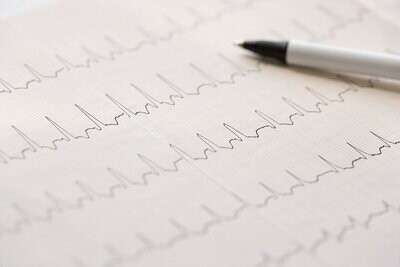 EKG