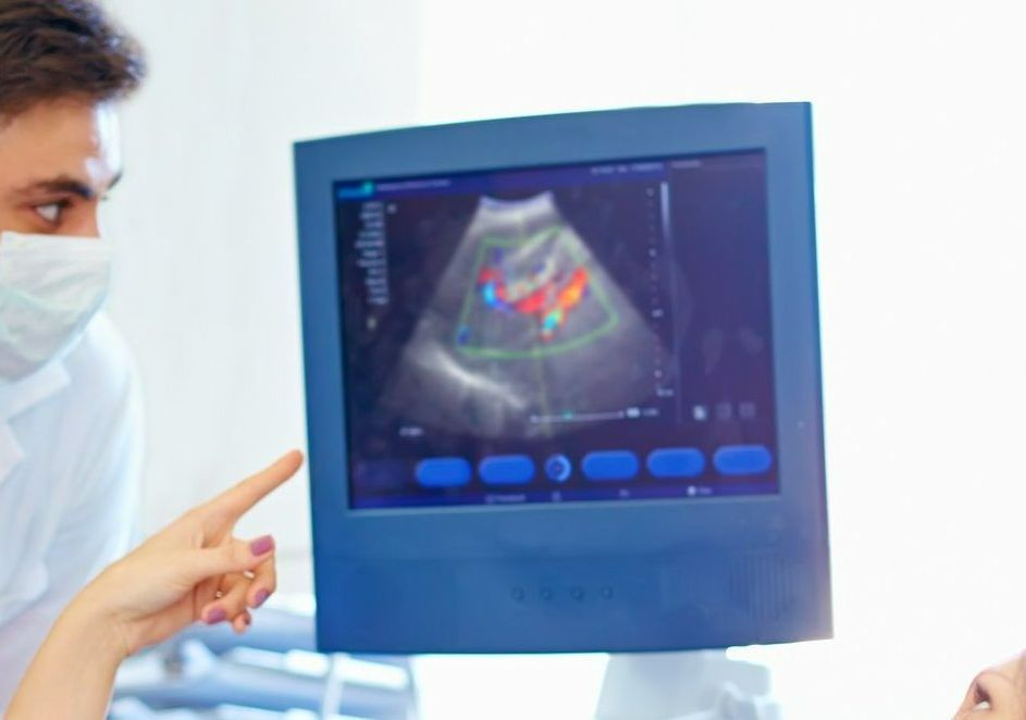 Ultraschall der Gefäße (Duplex Intima Media)