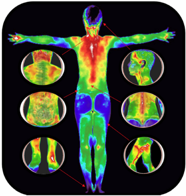 Thermography - Full Body Screening