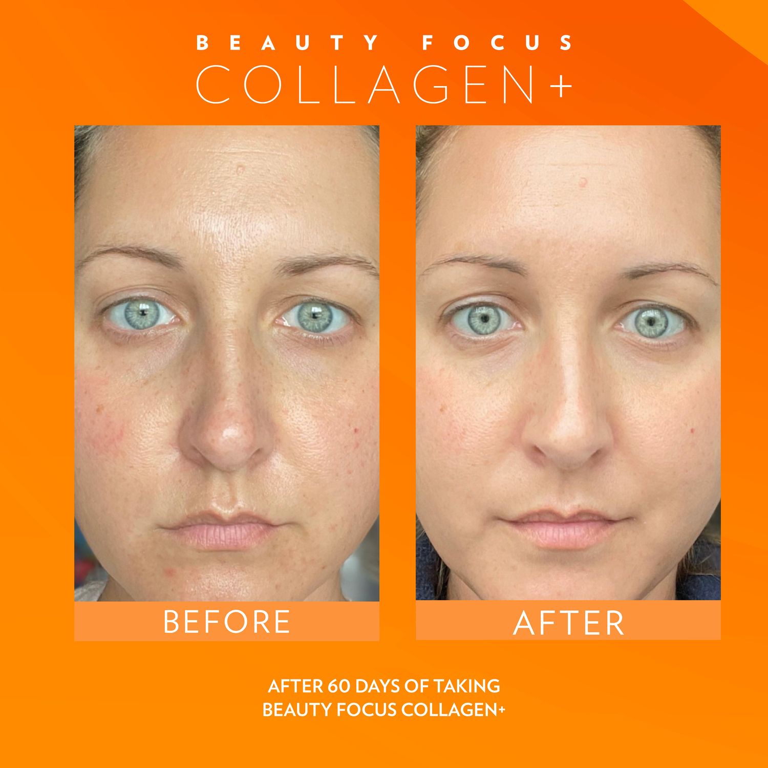 BeautyFocus Collagen+